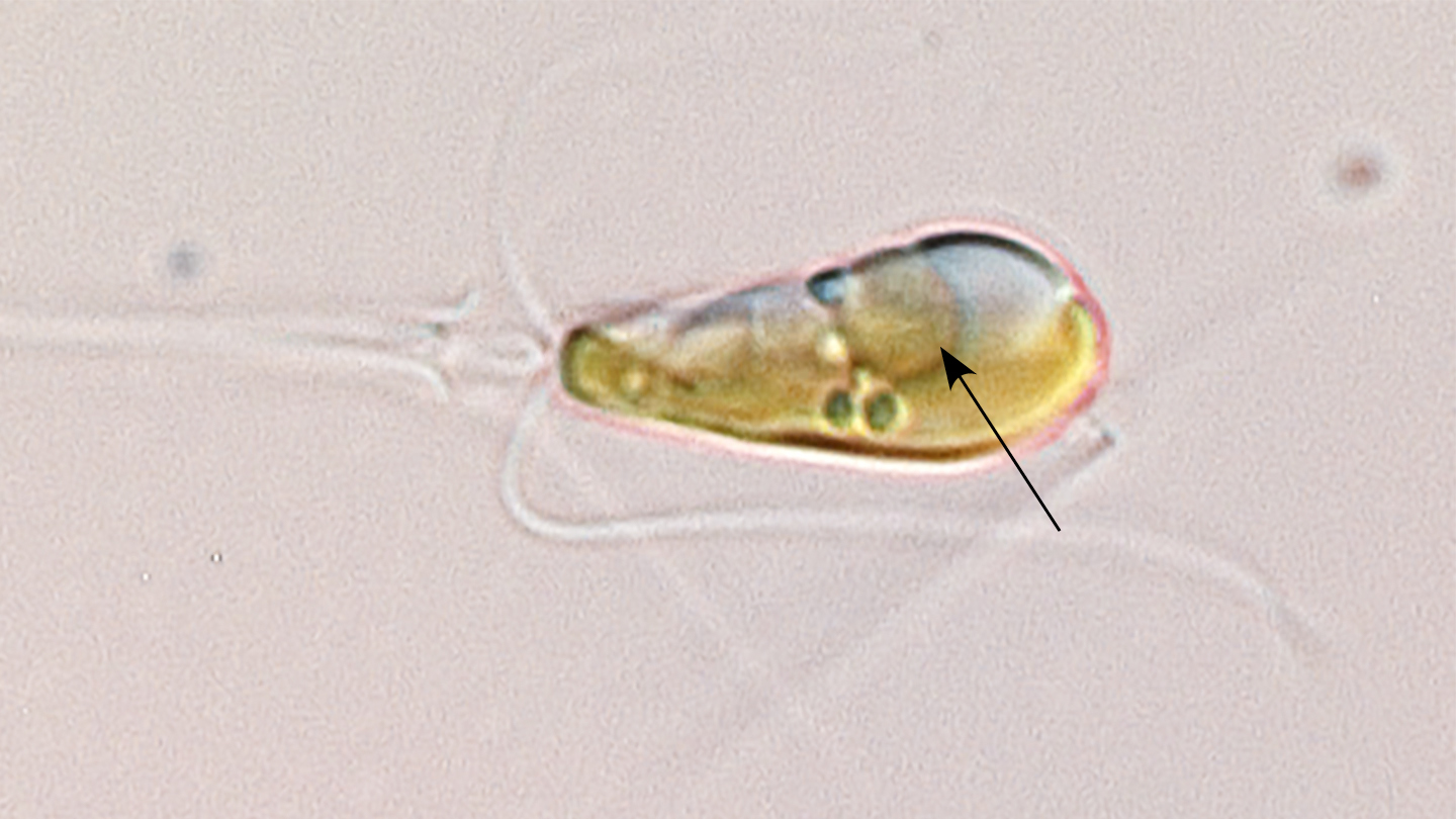 Organelles for nitrogen fixing in algae